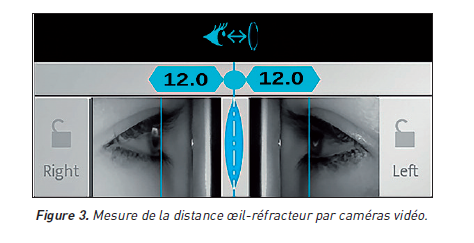 Figure 3 Mesure de la distance oeil réfracteur par caméras video